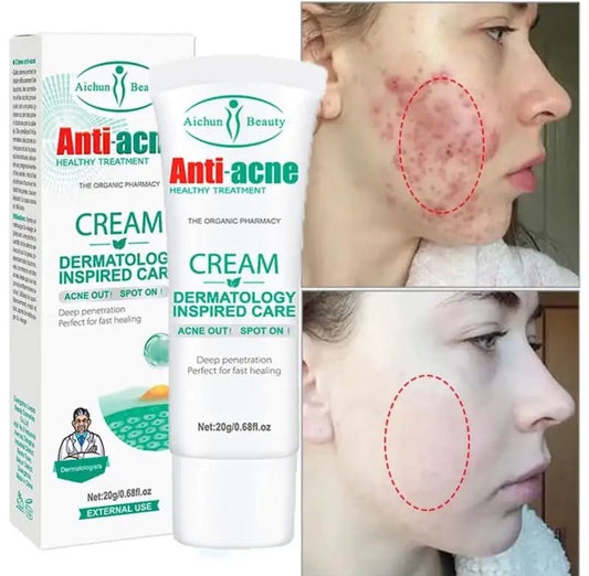 Anti acné